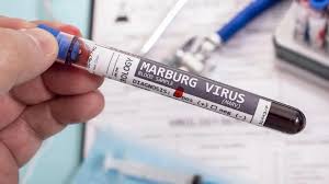 Virus de Marburg (MVD)