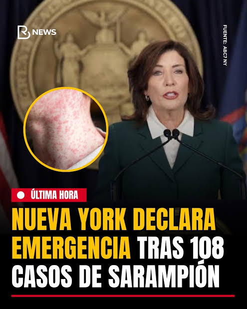 Alerta por brote de sarampión: Nueva York declara estado de emergencia ante aumento de casos